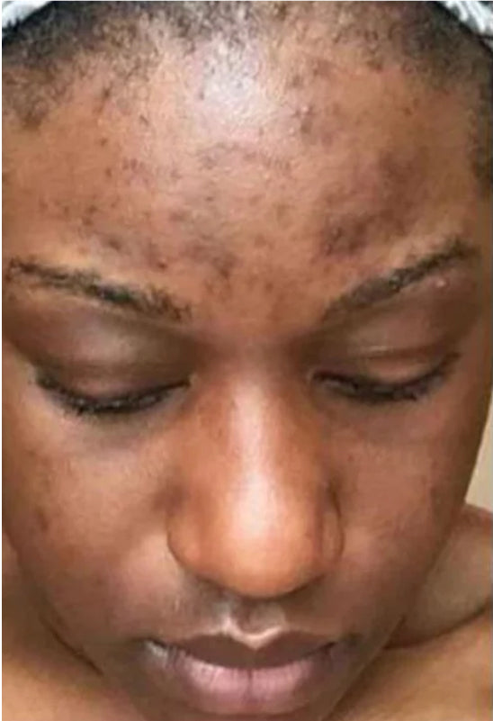 before-image