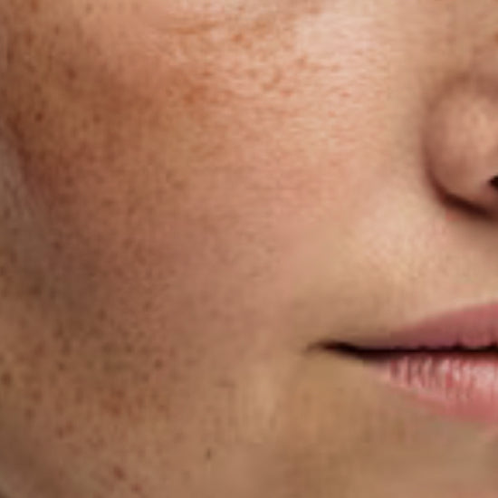 Dark Spots
